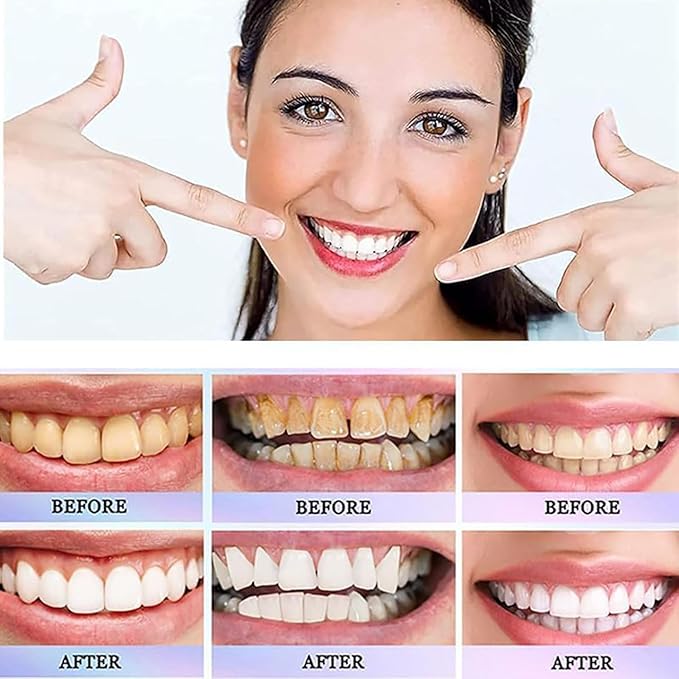 Oralhoe - Nicotinamide Dazzle White Toothpaste